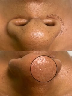 View Facial, Skin Treatments, Cosmetic - Tay Moore, Columbus, GA