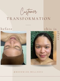 View Cosmetic, Facial, Skin Treatments - Tiffany Woodard, Tempe, AZ