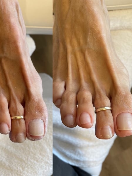 Image of  Nails, Pedicure