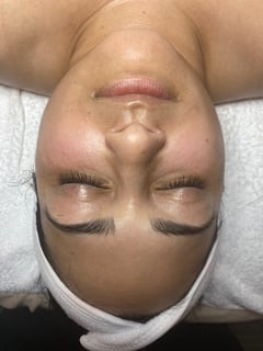 View Skin Treatments, Facial - Yari Santiago, Dracut, MA