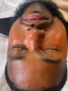 View Cosmetic, Facial, Skin Treatments - Jamila Bobbitt, Durham, NC