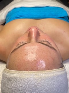 View Skin Treatments, Facial, Cosmetic - Monique Rennier , 
