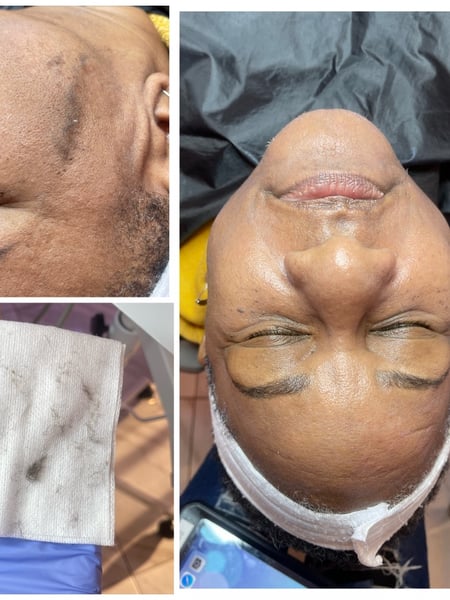 Image of  Waxing, Facial , Hair Removal