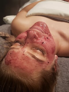 View Cosmetic, Skin Treatments, Facial - Blake Kehler, Cedar Rapids, IA