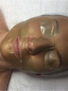 View Cosmetic, Skin Treatments, Facial - OLGA MARYNINA, San Diego, CA