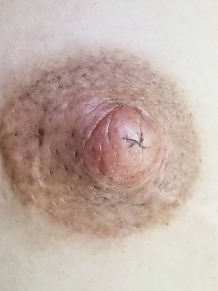 Image of  Cosmetic, Areola, Cosmetic Tattoos