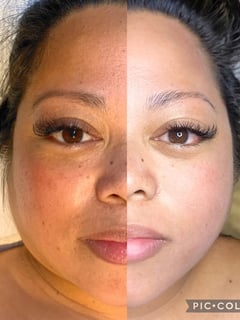 View Facial, Chemical Peel, Microdermabrasion, Skin, Mini Facelift, Minimally Invasive, Cosmetic - Kira Nalani, Chatsworth, CA