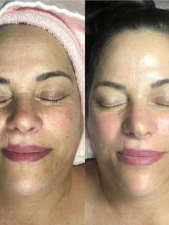 View Skin, Facial, Cosmetic - Aly Kesian, Fort Lauderdale, FL