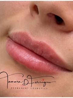 View Cosmetic, Lips, Filler - Tamara D Ferrigno, Henderson, NV
