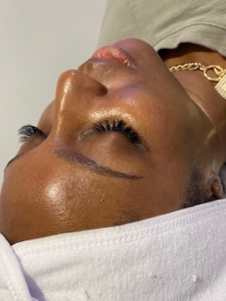 Image of  Cosmetic, Skin Treatments, Facial, Microdermabrasion, Chemical Peel, Waxing