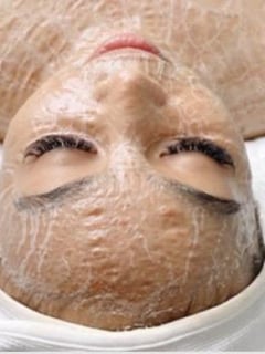 View Skin Treatments, Facial, Skin Treatments - Michelle Barie, Glendale, AZ