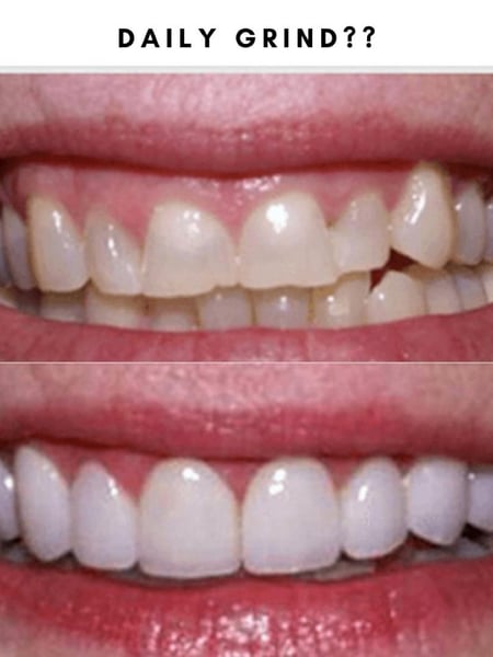 Image of  Dentistry, Porcelain Veneers, Dentistry Services