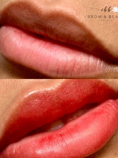View Lip Blush , Cosmetic Tattoos, Cosmetic - Julie Tseng, New York, NY