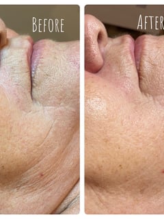 View Facial, Cosmetic, Skin Treatments - Salwa Elashmawy , Clearwater, FL