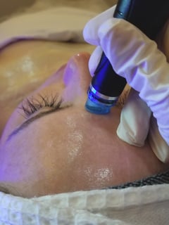 View Facial, Skin Treatments, Microdermabrasion - Esther Varner, Southern Pines, NC