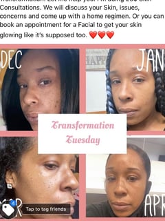 View Cosmetic, Skin Treatments, Facial - Jasmine Coleman, Oakland, CA