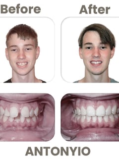 View Dentistry, Dental Braces, Dentistry Services - Bluffton Orthodontics, Bluffton, SC