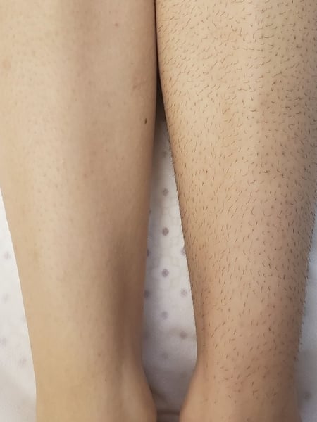 Image of  Cosmetic, Waxing, Skin Treatments, Legs 