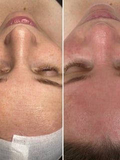 View Skin Treatments, Facial - Tatyana Fedoruk, Arlington, WA