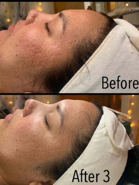 Image of  Cosmetic, Skin Treatments