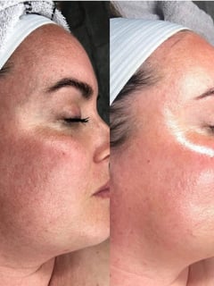 View Cosmetic, Skin, Facial - Aly Kesian, Fort Lauderdale, FL