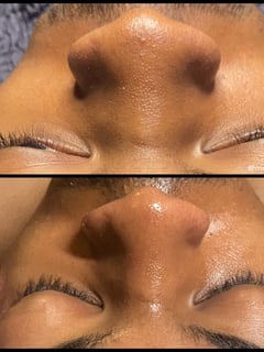 View Cosmetic, Skin Treatments, Facial - Monique Rennier , 