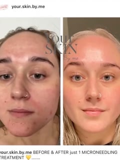 View Cosmetic, Facial, Skin Treatments - Katheryn Garcia, Boston, MA