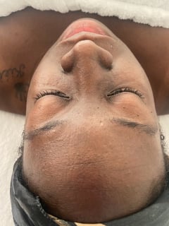 View Cosmetic, Facial, Skin Treatments - Jasmine Coleman, Oakland, CA