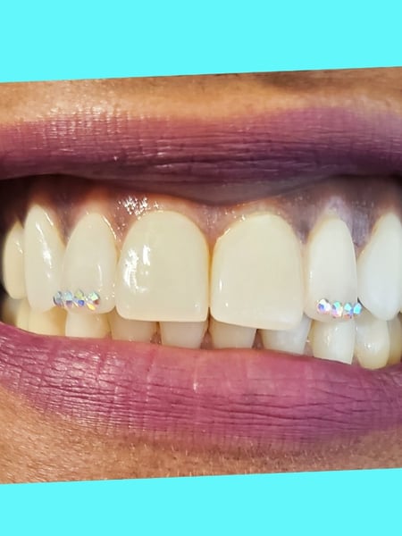 Image of  Filler, Lips, Cosmetic, Cosmetic Tattoos, Teeth Whitening, Lip Blush , Dentistry, Teeth Bleaching