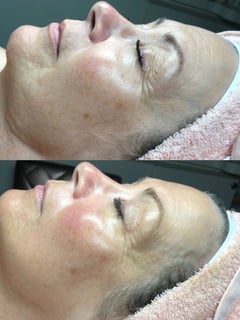 View Facial, Skin, Cosmetic - Aly Kesian, Fort Lauderdale, FL