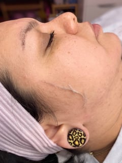 View Cosmetic, Skin Treatments, Facial - KATHRINE CASTILLO, San Antonio, TX