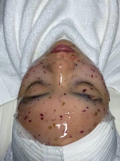View Microdermabrasion, Facial, Skin Treatments - Jennifer Wright, Dallas, TX