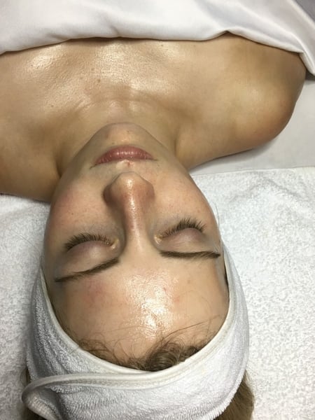 Image of  Cosmetic, Facial, Skin Treatments, Microdermabrasion