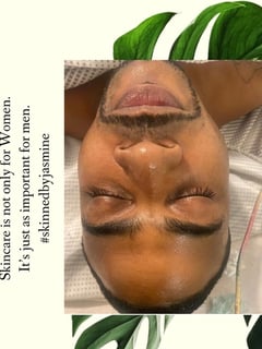 View Cosmetic, Facial, Skin Treatments - Jasmine Coleman, Oakland, CA