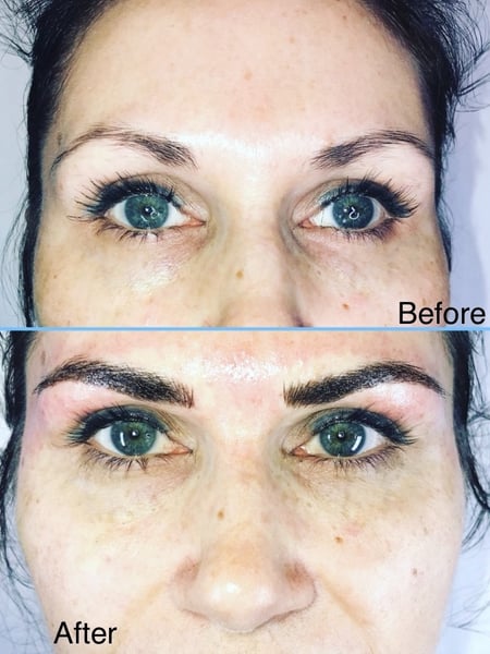 Image of  Cosmetic, Facial, Skin Treatments, Microdermabrasion, Chemical Peel, Neck Tightening, Minimally Invasive, Mini Facelift, Cosmetic Tattoos