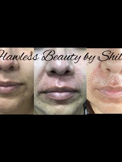 View Cosmetic, Minimally Invasive, Skin Treatments - Shilo Hope Stanley, La Mesa, CA