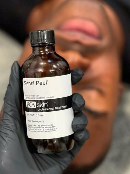 Image of  Chemical Peel, Skin Treatments
