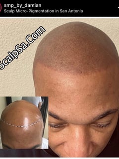 View Scalp Micropigmentation, Cosmetic Tattoos, Cosmetic - Damian Ambriz, San Antonio, TX