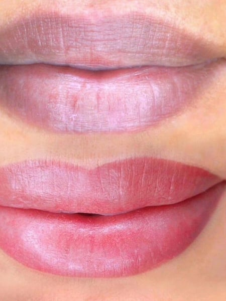 Image of  Filler, Cosmetic, Lip Blush , Cosmetic Tattoos